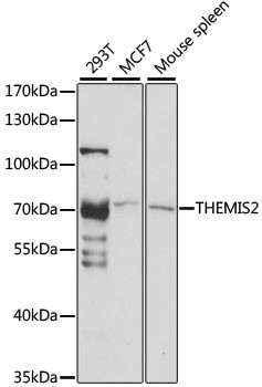 ICB-1 Antibody in Western Blot (WB)