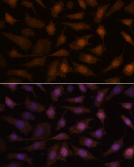 EEF1E1 Antibody in Immunocytochemistry (ICC/IF)