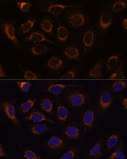 TCIRG1 Antibody in Immunocytochemistry (ICC/IF)