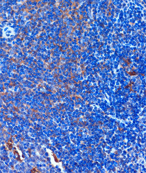 TCIRG1 Antibody in Immunohistochemistry (Paraffin) (IHC (P))