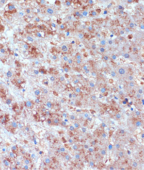 TCIRG1 Antibody in Immunohistochemistry (Paraffin) (IHC (P))