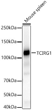 TCIRG1 Antibody in Western Blot (WB)