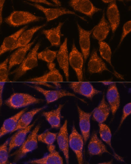 SEMA3C Antibody in Immunocytochemistry (ICC/IF)