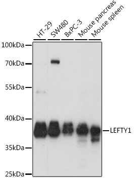 LEFTY Antibody in Western Blot (WB)