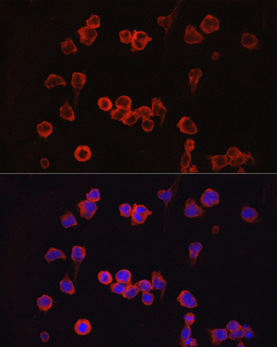 NFATC1 Antibody in Immunocytochemistry (ICC/IF)