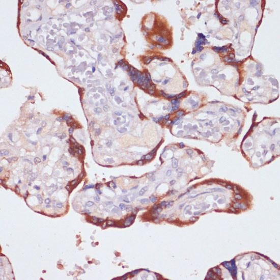 NFATC1 Antibody in Immunohistochemistry (Paraffin) (IHC (P))