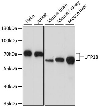 UTP18 Antibody in Western Blot (WB)