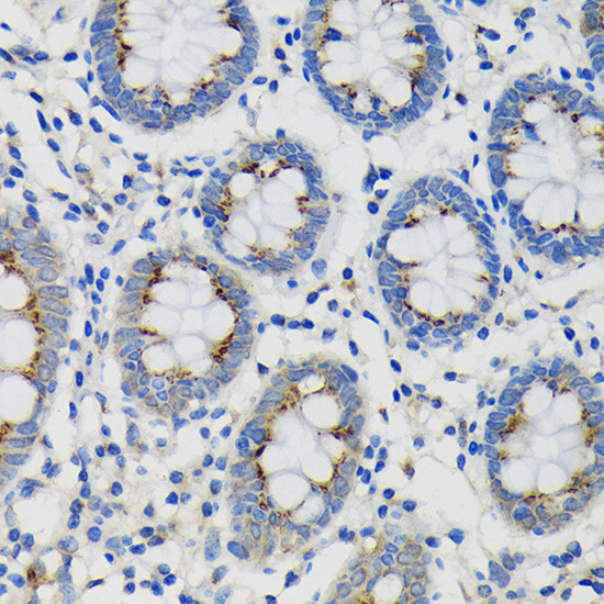 SDF4 Antibody in Immunohistochemistry (Paraffin) (IHC (P))