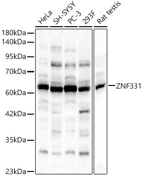 ZNF331 Antibody in Western Blot (WB)