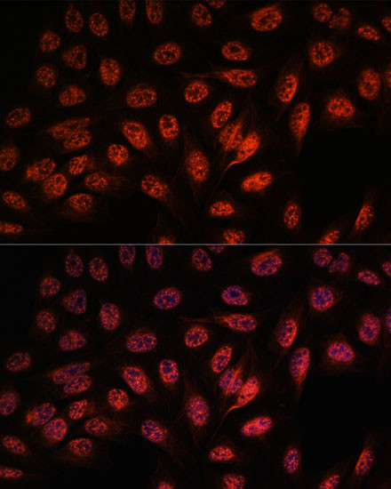 RBM25 Antibody in Immunocytochemistry (ICC/IF)