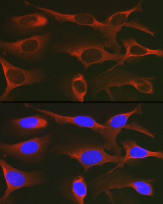 WNK3 Antibody in Immunocytochemistry (ICC/IF)