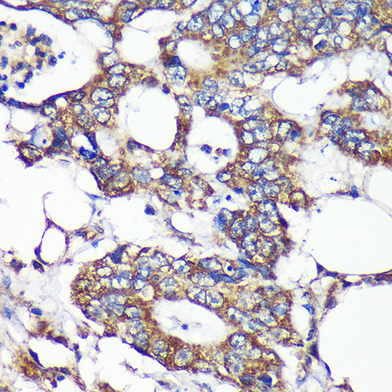 SLIRP Antibody in Immunohistochemistry (Paraffin) (IHC (P))