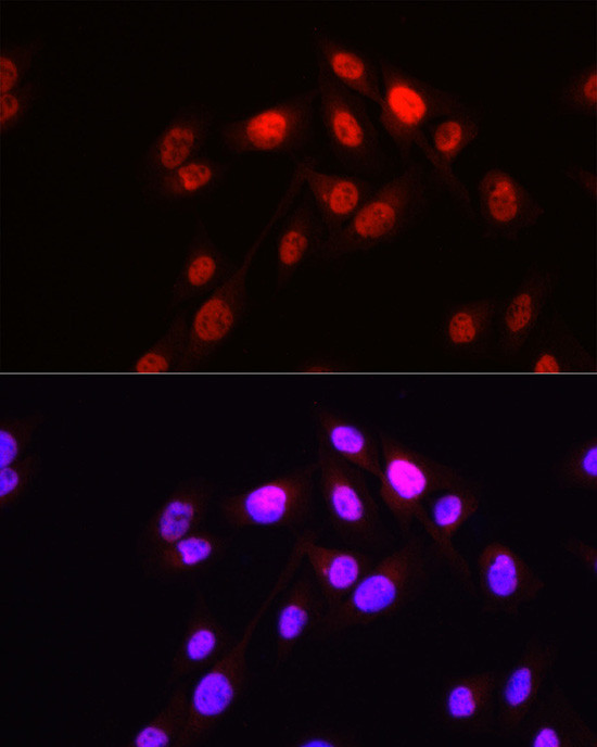 Hopx Antibody in Immunocytochemistry (ICC/IF)