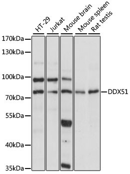 DDX51 Antibody in Western Blot (WB)