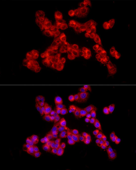 Collagen II Antibody in Immunocytochemistry (ICC/IF)