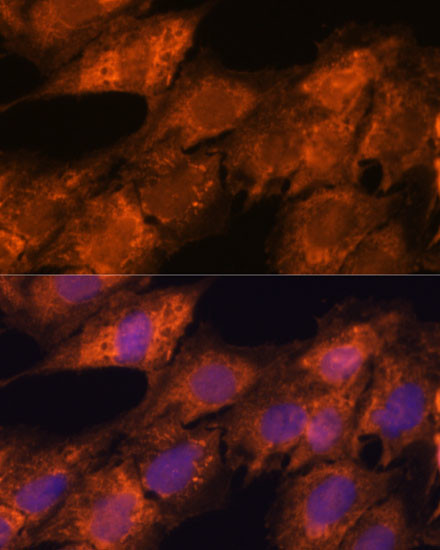 Importin 4 Antibody in Immunocytochemistry (ICC/IF)