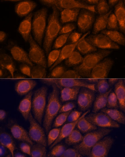 Importin 4 Antibody in Immunocytochemistry (ICC/IF)