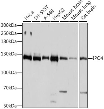 Importin 4 Antibody in Western Blot (WB)