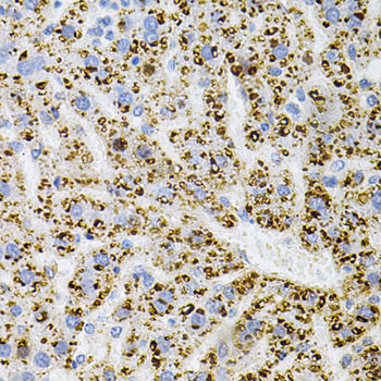 TrkA Antibody in Immunohistochemistry (Paraffin) (IHC (P))