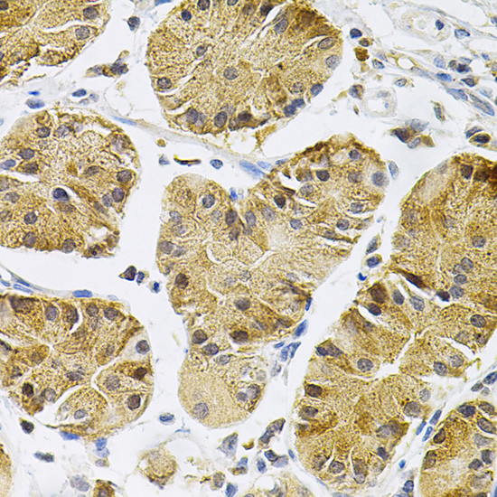 TrkA Antibody in Immunohistochemistry (Paraffin) (IHC (P))