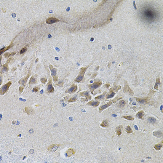 TrkA Antibody in Immunohistochemistry (Paraffin) (IHC (P))