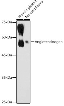 Angiotensinogen Antibody in Western Blot (WB)