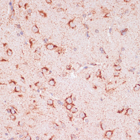 ENTPD6 Antibody in Immunohistochemistry (Paraffin) (IHC (P))