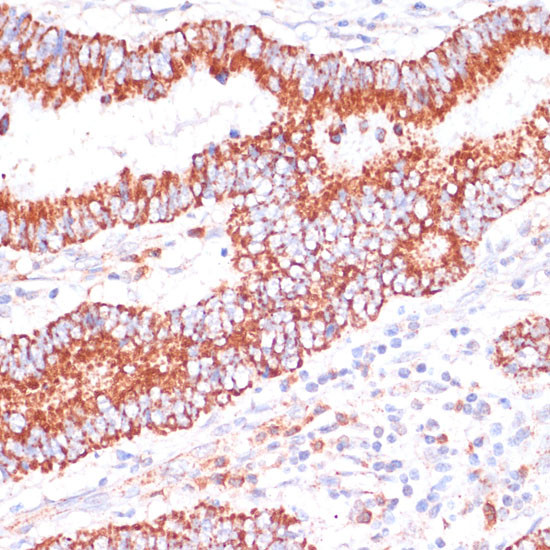 ENTPD6 Antibody in Immunohistochemistry (Paraffin) (IHC (P))