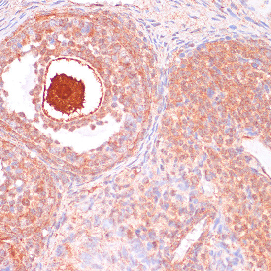 Cdc20 Antibody in Immunohistochemistry (Paraffin) (IHC (P))