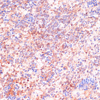 Cdc20 Antibody in Immunohistochemistry (Paraffin) (IHC (P))