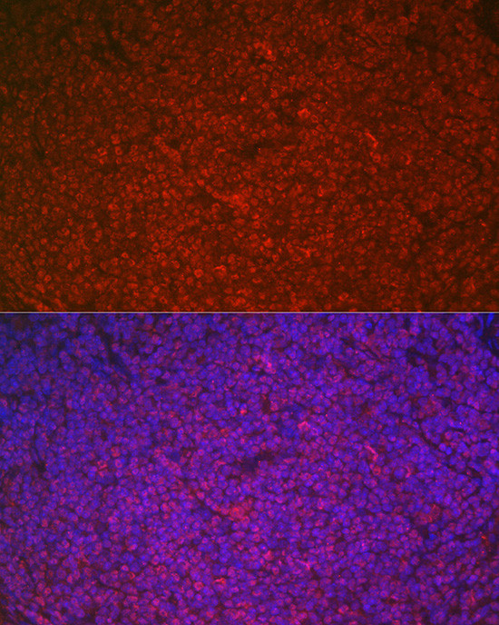 ETS1 Antibody in Immunocytochemistry (ICC/IF)