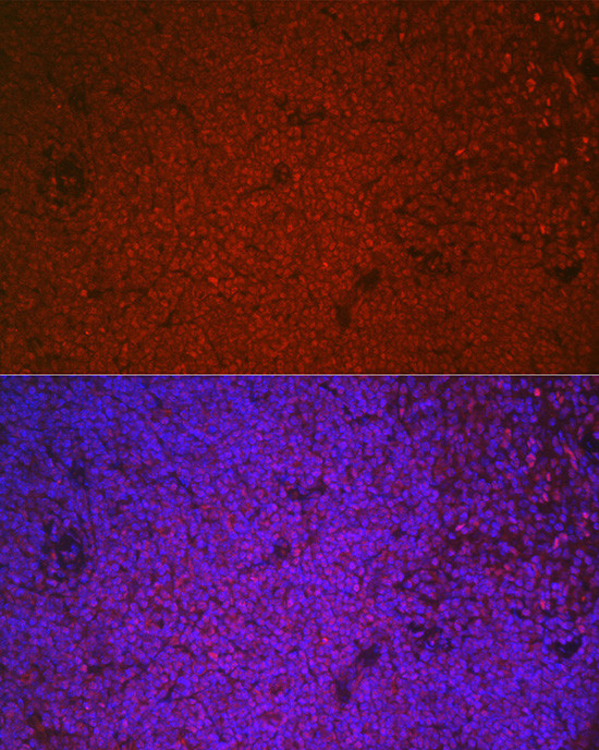 ETS1 Antibody in Immunocytochemistry (ICC/IF)