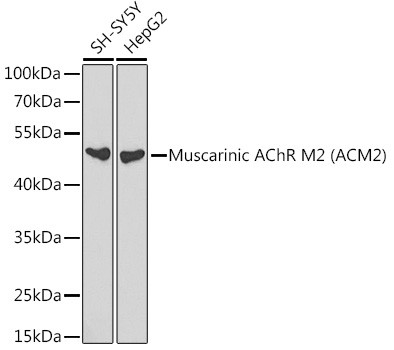 CHRM2 Antibody in Western Blot (WB)