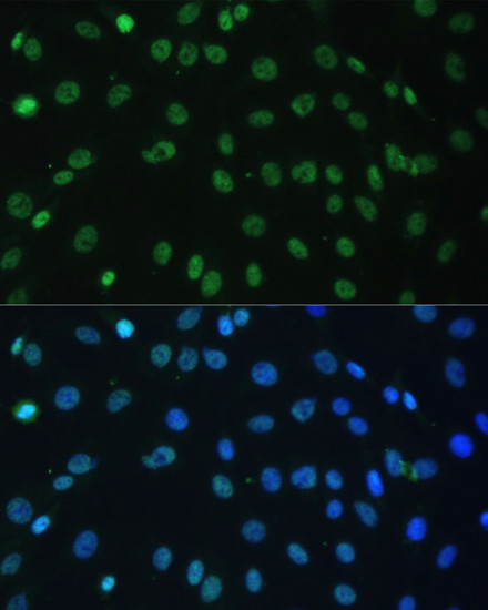 hnRNP D Antibody in Immunocytochemistry (ICC/IF)