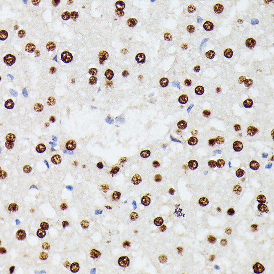 hnRNP D Antibody in Immunohistochemistry (Paraffin) (IHC (P))