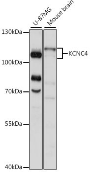 KV3.4 (KCNC4) Antibody in Western Blot (WB)