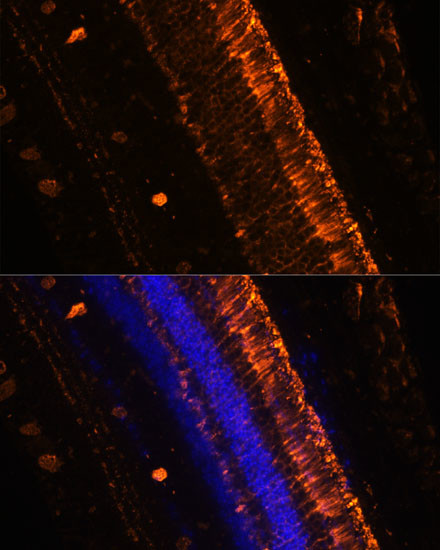 KCNS2 Antibody in Immunohistochemistry (Paraffin) (IHC (P))