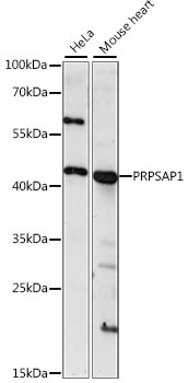 PRPSAP1 Antibody in Western Blot (WB)