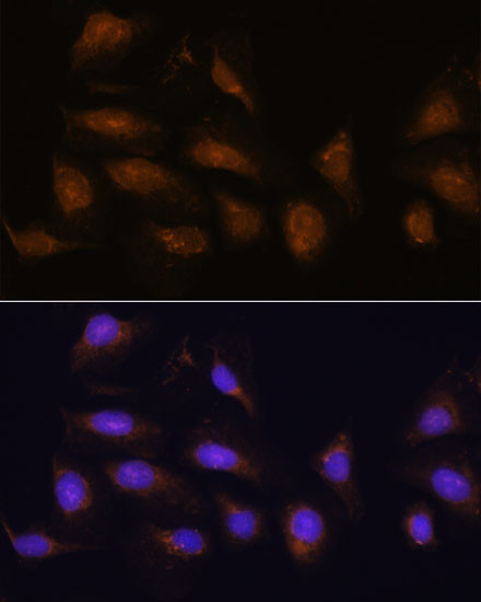 RSK1 Antibody in Immunocytochemistry (ICC/IF)