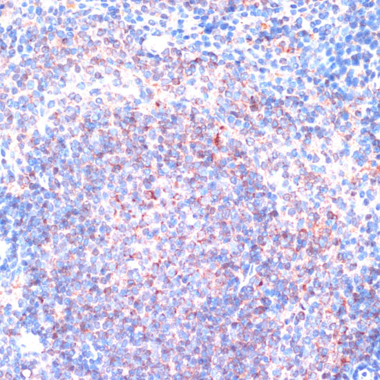 RSK1 Antibody in Immunohistochemistry (Paraffin) (IHC (P))