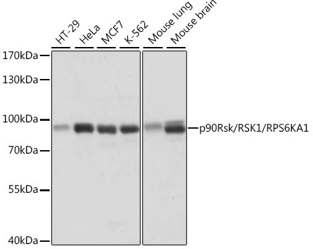 RSK1 Antibody in Western Blot (WB)