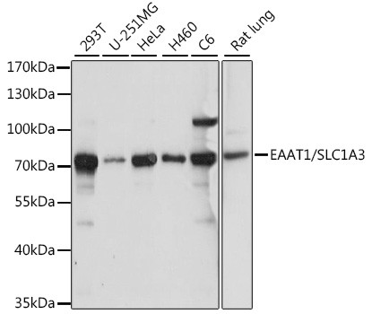 GLAST Antibody in Western Blot (WB)