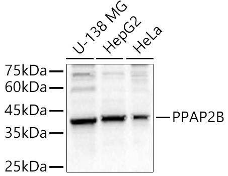 PPAP2B Antibody in Western Blot (WB)