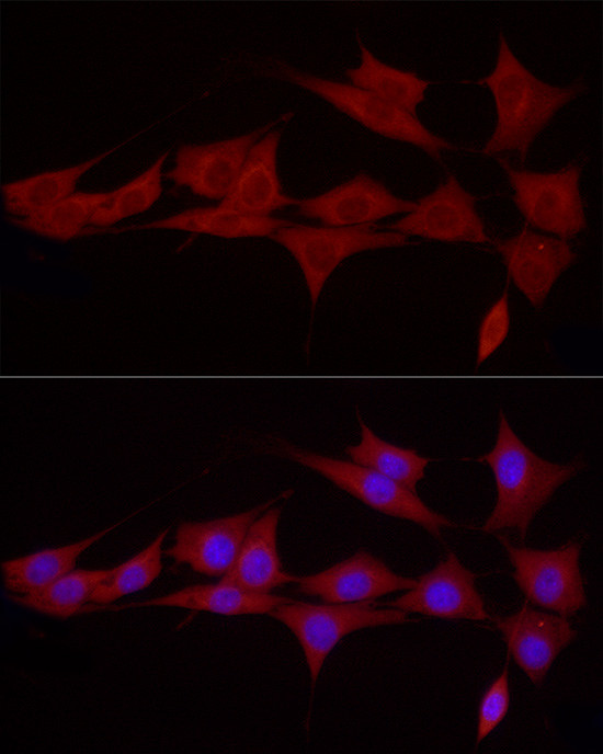 SGPL1 Antibody in Immunocytochemistry (ICC/IF)