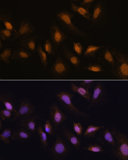 HCC1 Antibody in Immunocytochemistry (ICC/IF)