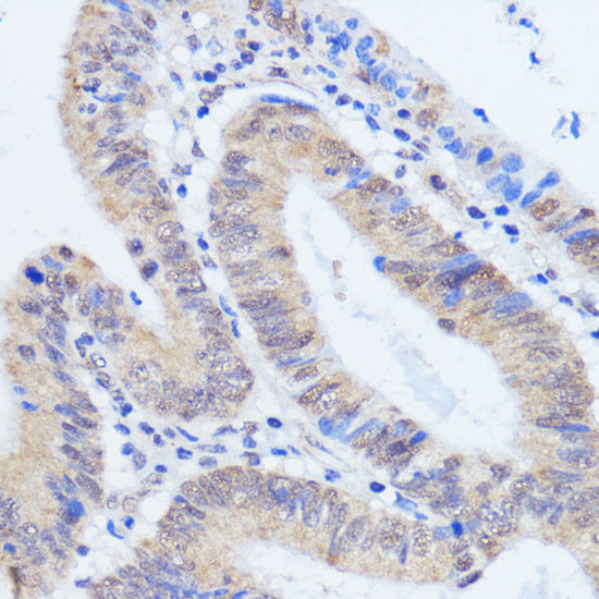 HCC1 Antibody in Immunohistochemistry (Paraffin) (IHC (P))