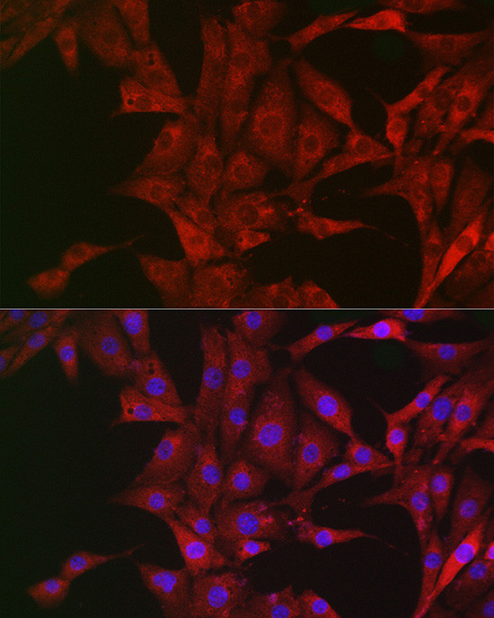 Bim Antibody in Immunocytochemistry (ICC/IF)