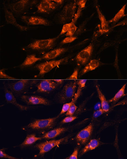 TENM1 Antibody in Immunocytochemistry (ICC/IF)