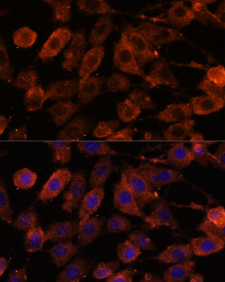 TENM1 Antibody in Immunocytochemistry (ICC/IF)