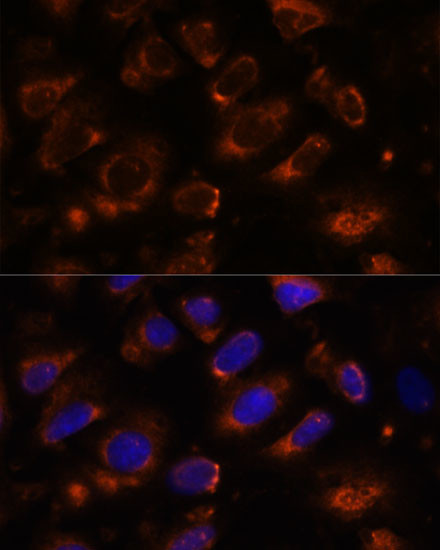 TENM1 Antibody in Immunocytochemistry (ICC/IF)